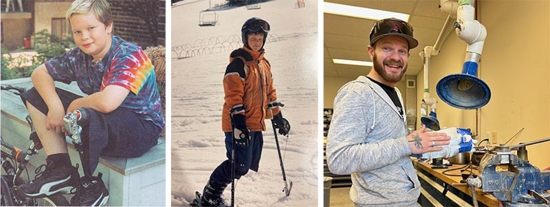 Three photos: Left: A young child with a prosthetic Leg. Centre: A teenager skiing. Right: An adult working in a workshop.